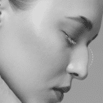 تصویر قبل از درمان