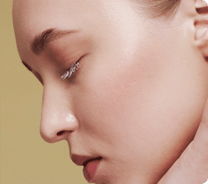 تزریق فیلر بینی جهت اصلاح فرم - بعد از درمان