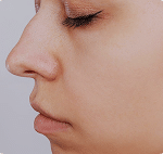 تصویر قبل از درمان