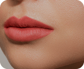 تزریق فیلر لب متد روسی - بعد از درمان