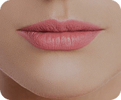 تزریق فیلر لب متد روسی - قبل از درمان