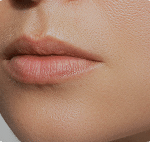 تصویر قبل از درمان